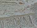 Galectin 3 Monoclonal Antibody – Figure 1 of 2