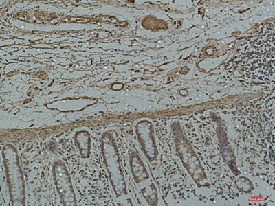 Galectin 3 Monoclonal Antibody – Figure 1 of 2