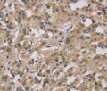 DCN Polyclonal Antibody – Figure 1 of 3