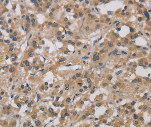 DCN Polyclonal Antibody – Figure 1 of 3