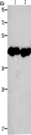 CKM Polyclonal Antibody – Figure 1 of 3