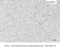 Immortalized Human Lymphoblastoid Cells – EBV (KMS-15) – Figure 1 of 1
