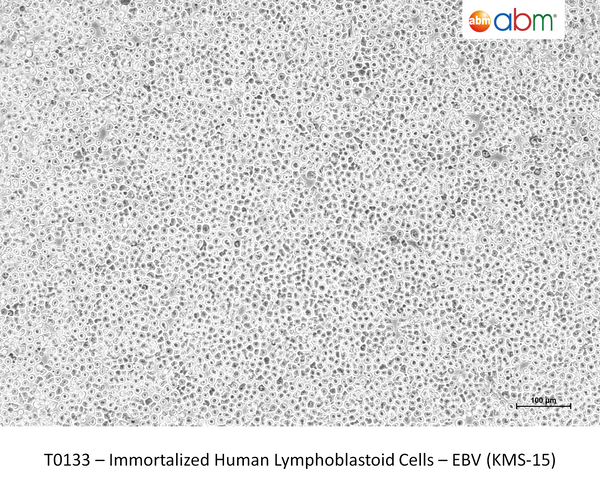 Immortalized Human Lymphoblastoid Cells – EBV (KMS-15) – Figure 1 of 1