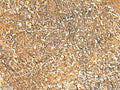 GSG1L Polyclonal Antibody – Figure 1 of 3