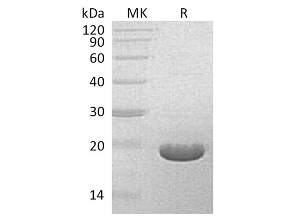 Recombinant Streptomyces hygroscopicus Bar Protein – Figure 1 of 2