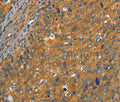 CIB1 Polyclonal Antibody – Figure 1 of 3