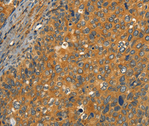 CIB1 Polyclonal Antibody – Figure 1 of 3