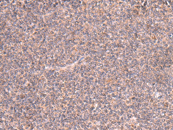 MRPS24 Polyclonal Antibody – Figure 1 of 3