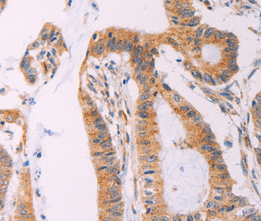 ADCY1 Polyclonal Antibody – Figure 1 of 3