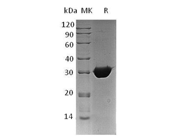 Recombinant Human BPGM Protein (His Tag) – Figure 1 of 2
