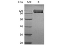 Recombinant Human ALCAM/CD166 Protein (Fc Tag) – Figure 1 of 2