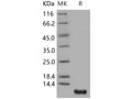Recombinant Human S100P/S100E Protein – Figure 1 of 2