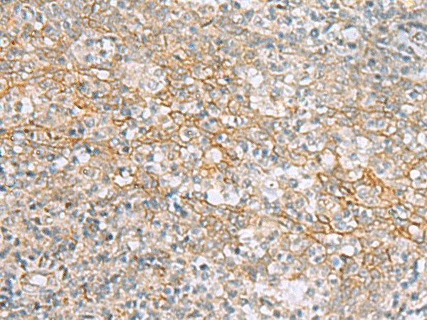 KCNH7 Polyclonal Antibody – Figure 1 of 2