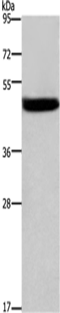 Cathepsin E Polyclonal Antibody – Figure 1 of 4