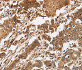 CALU Polyclonal Antibody – Figure 1 of 3