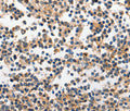 INHA Polyclonal Antibody – Figure 1 of 2