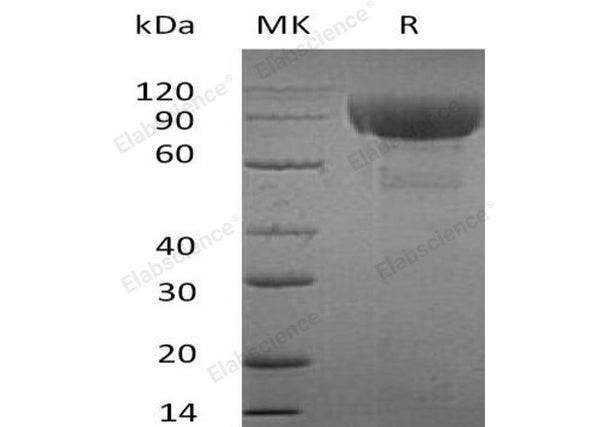 Recombinant Human IL-1RL2 Protein (Fc Tag) – Figure 1 of 2