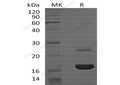 Recombinant Human MYDGF Protein (His Tag) – Figure 1 of 2