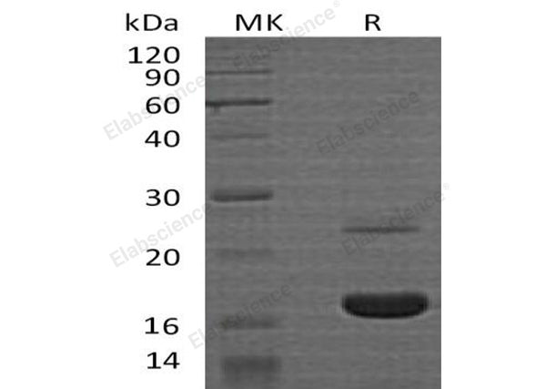 Recombinant Human MYDGF Protein (His Tag) – Figure 1 of 2