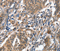 ALOX15 Polyclonal Antibody – Figure 1 of 3