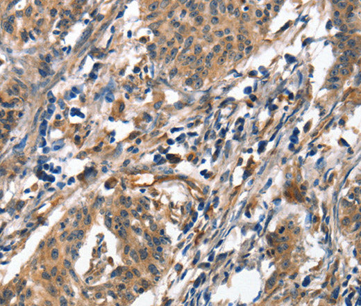 ALOX15 Polyclonal Antibody – Figure 1 of 3