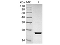 Recombinant Human IL-1RA/IL1RN Protein – Figure 1 of 2
