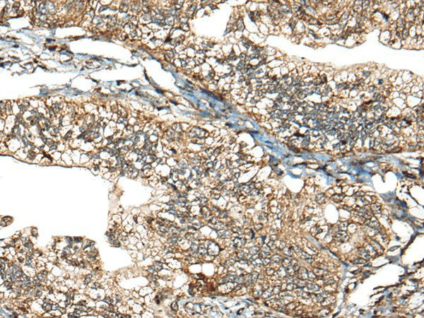 CALHM1 Polyclonal Antibody – Figure 1 of 2