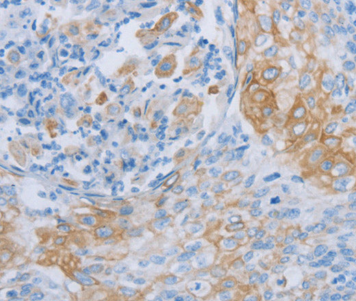 ADRB3 Polyclonal Antibody – Figure 1 of 2