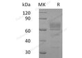 Recombinant Human Podoplanin/PDPN Protein (Fc Tag) – Figure 1 of 2