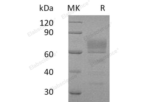 Recombinant Human Podoplanin/PDPN Protein (Fc Tag) – Figure 1 of 2