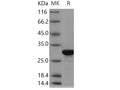 Recombinant Human BPHL Protein (His Tag) – Figure 1 of 2