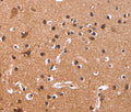 CSNK1D Polyclonal Antibody – Figure 1 of 3