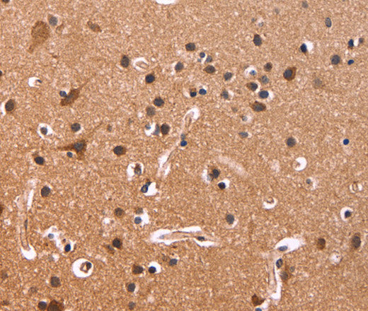 CSNK1D Polyclonal Antibody – Figure 1 of 3