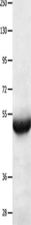 BPIFB3 Polyclonal Antibody – Figure 1 of 4