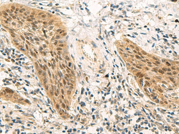 PSME1 Polyclonal Antibody – Figure 1 of 2