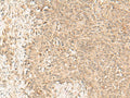 FBXL4 Polyclonal Antibody – Figure 1 of 3