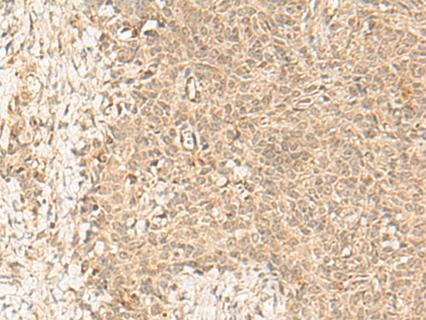 FBXL4 Polyclonal Antibody – Figure 1 of 3