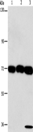 CKAP4 Polyclonal Antibody – Figure 1 of 4