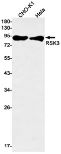 Recombinant RSK3 Monoclonal Antibody – Figure 1 of 3