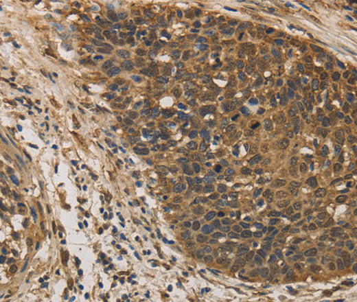 DACH1 Polyclonal Antibody – Figure 1 of 3