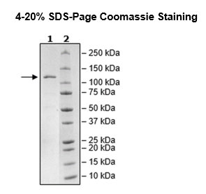 PDE4A Isoform 4, GST-Tag, His-Tag Recombinant – Figure 1 of 2