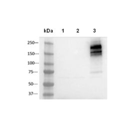 CFTR HEK293 Recombinant Cell Line – Figure 1 of 3