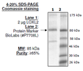Lysyl Oxidase-like 2 (LOXL2), His-tag (HEK293-derived) Recombinant – Figure 1 of 1