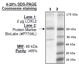 Lysyl Oxidase-like 2 (LOXL2), His-tag (HEK293-derived) Recombinant – Figure 1 of 1