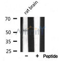 Tubulin gamma Antibody – Figure 1 of 4