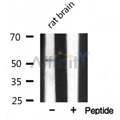 Tubulin gamma Antibody – Figure 1 of 4