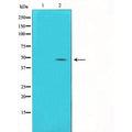 alpha SMA Antibody – Figure 1 of 4