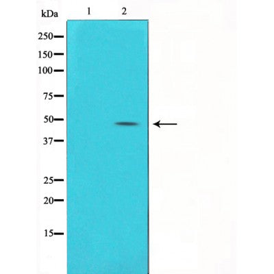 alpha SMA Antibody – Figure 1 of 4