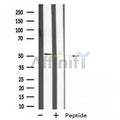 MKNK2 Antibody – Figure 1 of 1