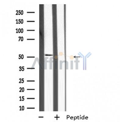 MKNK2 Antibody – Figure 1 of 1